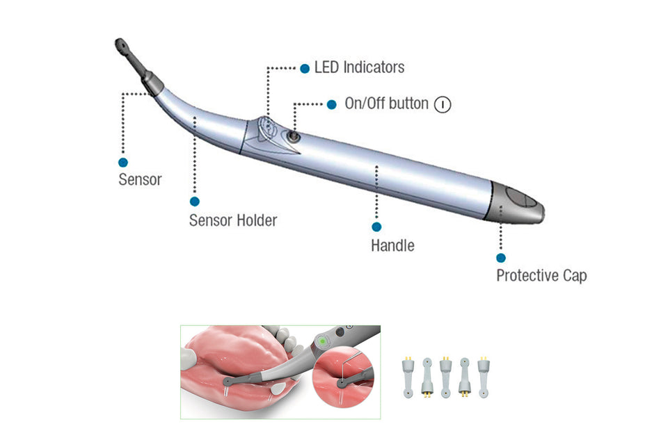 Implant Spotter