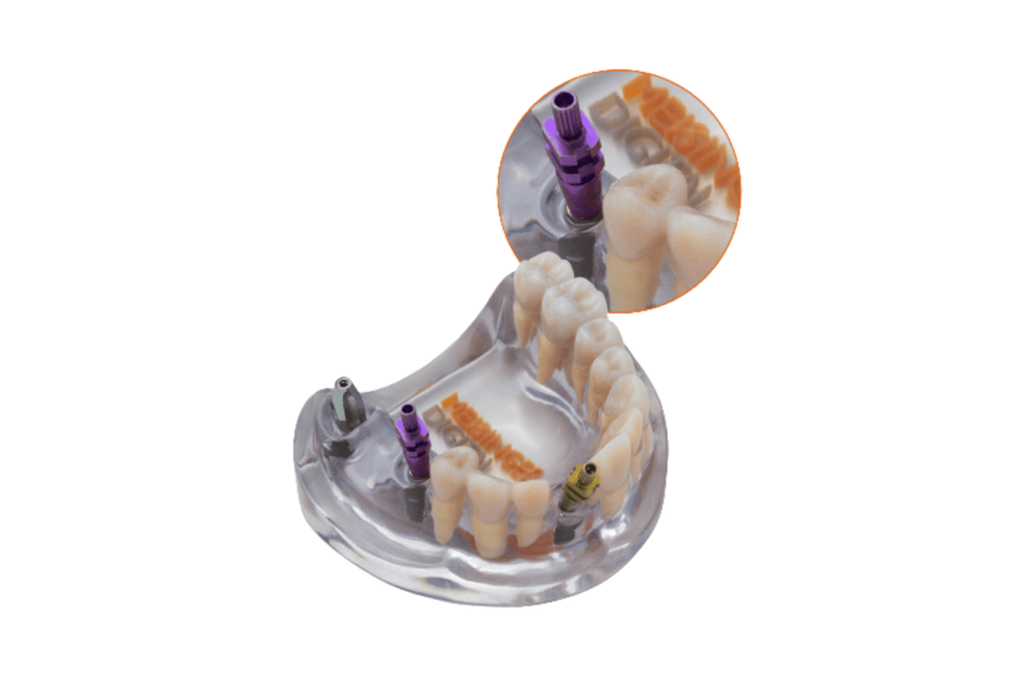 4D training teeth and educational models: Tooth 21