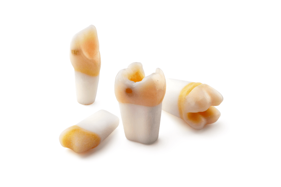 4D training teeth and educational models: Tooth 11