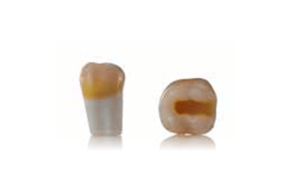 4D training light and model: Tooth 37 - AUTUMN 24